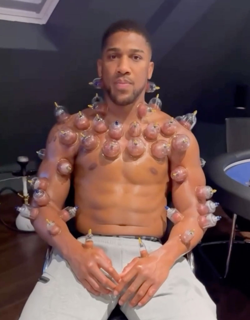 Anthony Joshua